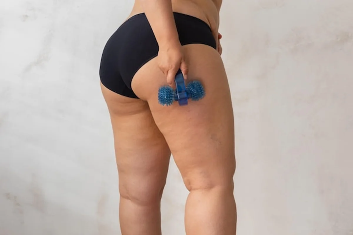 Kobieta z nadwagą w bieliźnie wykonuje masaż na cellulit bioder z użyciem niebieskiego wałka samoprzylepnego