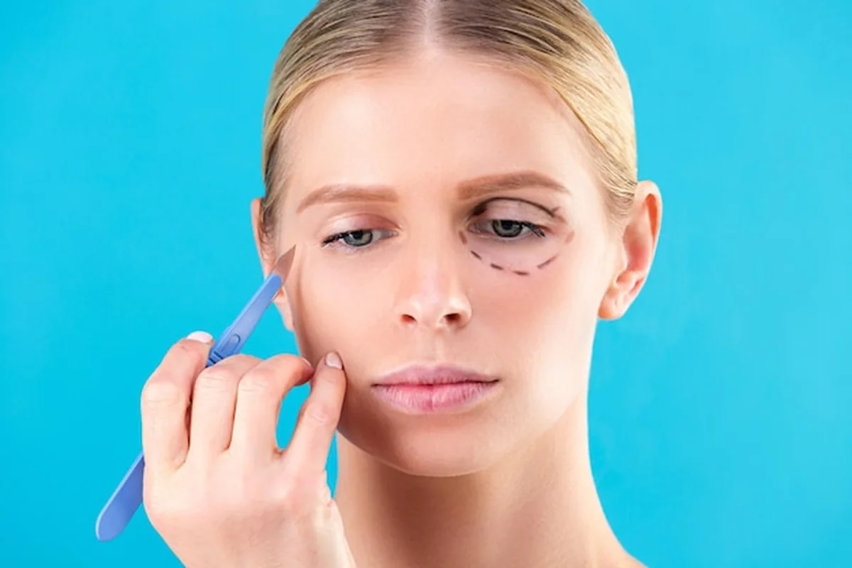 Konsultacja przed liftingiem powiek - lekarz rysuje linie operacyjne, przygotowanie do blefaroplastyki