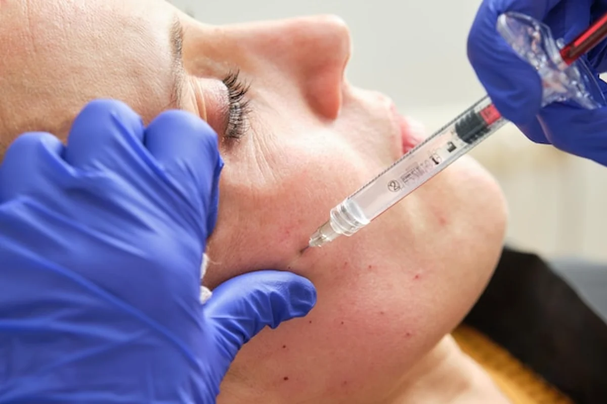 Mezoterapia twarzy z kwasem hialuronowym dla pięknej skóry i młodzieńczego wyglądu