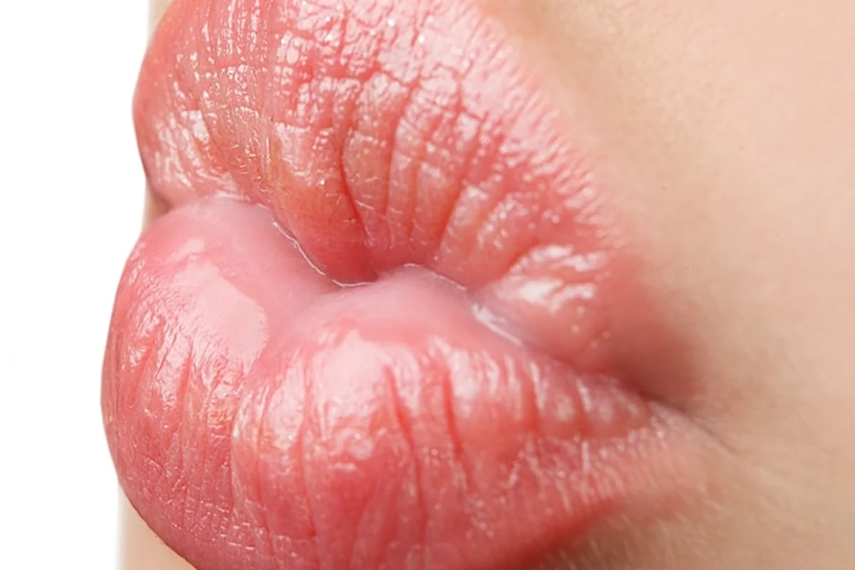 Jak powiększyć usta kwasem hialuronowym? Sposoby na pełne usta