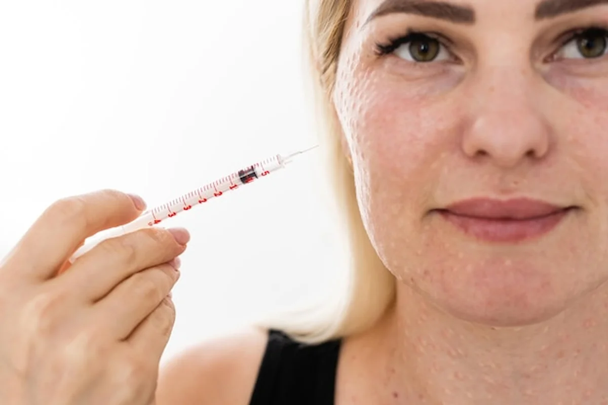 Mezoterapia na szyję i dekolt z kwasem hialuronowym. Ślady wstrzyknięć na jasnym tle