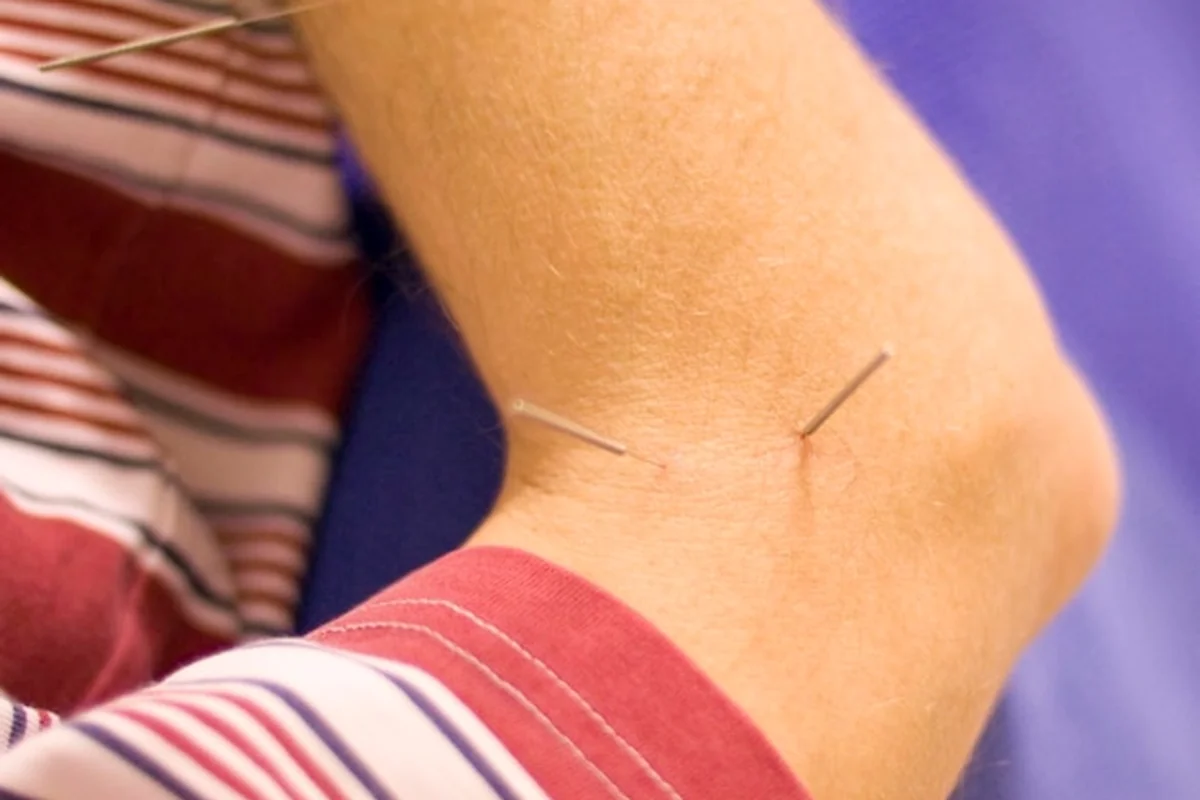 Jak usunąć kurzajkę? Domowe sposoby i leczenie brodawek