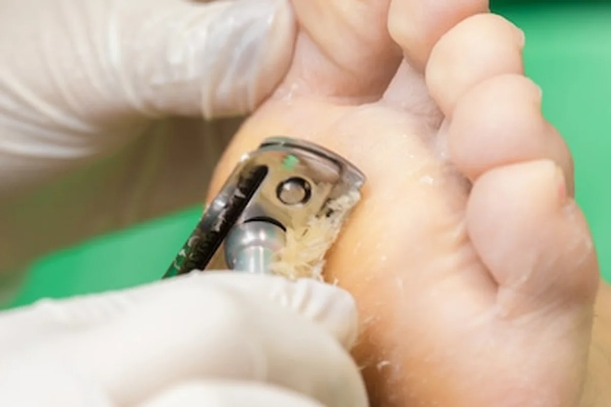 Procedura pedicure w salonie kosmetycznym usuwająca modzele na stopach